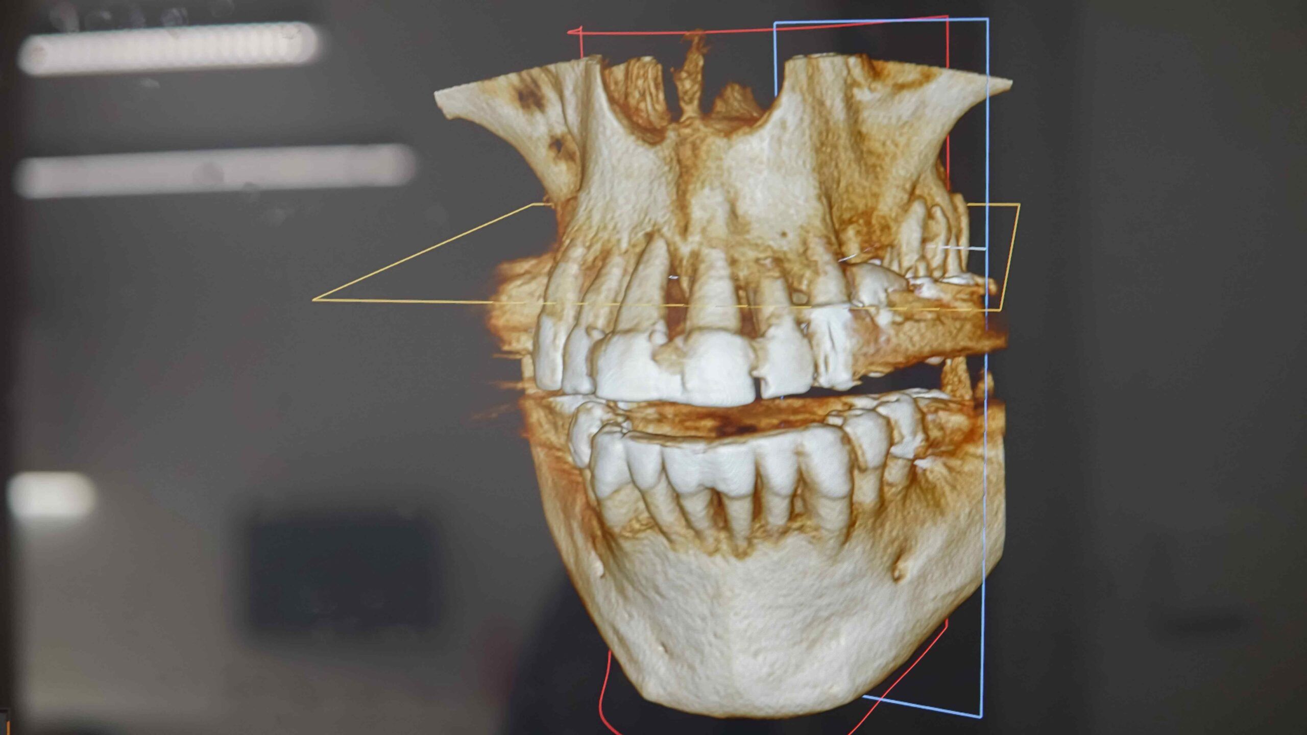 cbct-3d-airam
