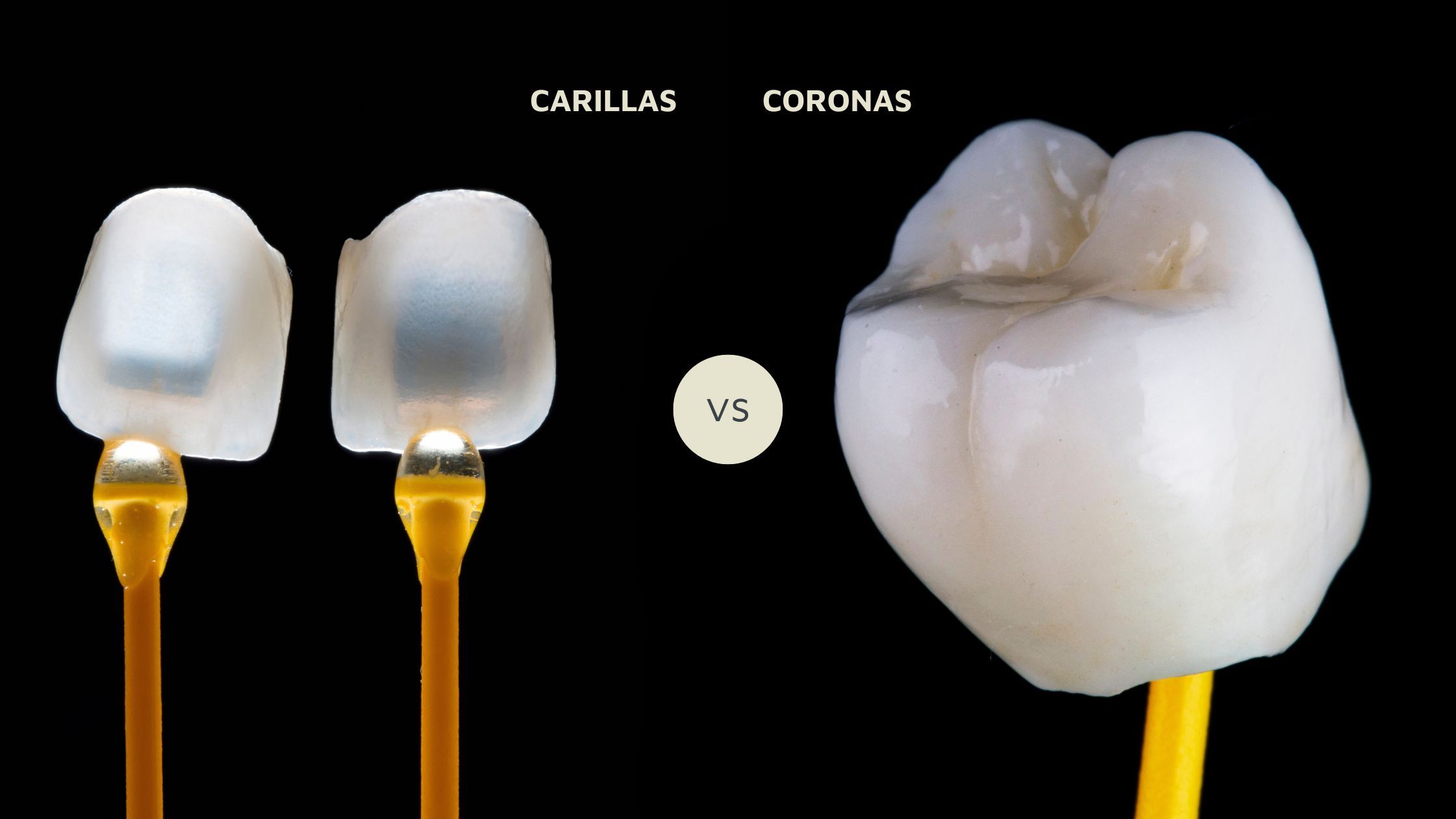 carillas-vs-coronas